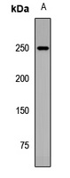 ARID2 Rabbit Polyclonal Antibody