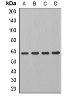 ALDH7A1 Rabbit Polyclonal Antibody