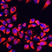 ALDH7A1 Rabbit Polyclonal Antibody