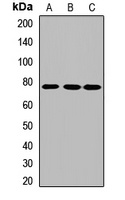 FERMT2 Rabbit Polyclonal Antibody