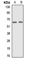 VPS33B Rabbit Polyclonal Antibody