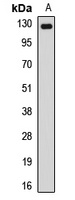 NUP133 Rabbit Polyclonal Antibody