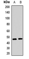 APOBEC3B Rabbit Polyclonal Antibody
