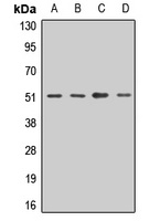 OST48 Rabbit Polyclonal Antibody
