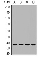 NAGK Rabbit Polyclonal Antibody