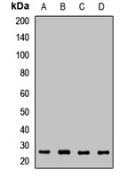 VPS28 Rabbit Polyclonal Antibody