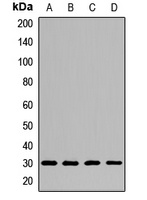 CLPP Rabbit Polyclonal Antibody