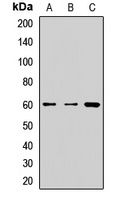 FTCD Rabbit Polyclonal Antibody