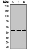 IMPDH1 Rabbit Polyclonal Antibody