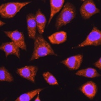 IMPDH1 Rabbit Polyclonal Antibody