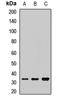 PHOX2B Rabbit Polyclonal Antibody
