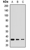 Calretinin Rabbit Polyclonal Antibody