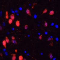 Calretinin Rabbit Polyclonal Antibody