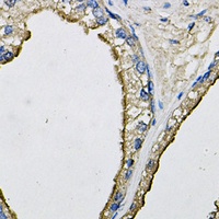 LCN1 Antibody