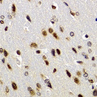 BAZ1B Rabbit Polyclonal Antibody