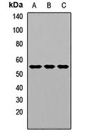 Alpha-2-antiplasmin Rabbit Polyclonal Antibody