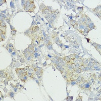 SOCS6 Antibody
