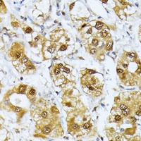 RagD Rabbit Polyclonal Antibody