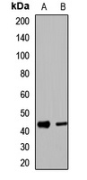 UBE2Q2 Rabbit Polyclonal Antibody