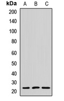 MYL6B Rabbit Polyclonal Antibody