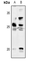 Thymidine Kinase 1 Rabbit Polyclonal Antibody