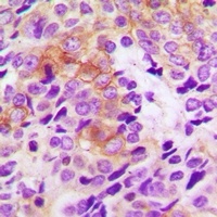 Thymidine Kinase 1 Rabbit Polyclonal Antibody