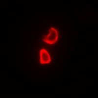 Thymidine Kinase 1 Rabbit Polyclonal Antibody
