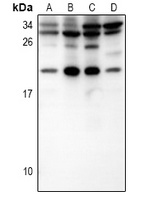 IL-15 Antibody