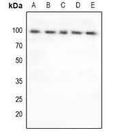 FOXO3 Rabbit Polyclonal Antibody