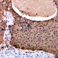 FOXO3 Rabbit Polyclonal Antibody