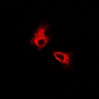 FOXO3 Rabbit Polyclonal Antibody