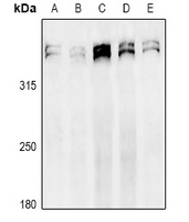 Ki67 Antibody