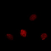 Ki67 Antibody