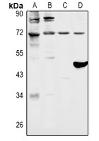 FOXO1 Rabbit Polyclonal Antibody