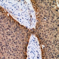 FOXO1 Rabbit Polyclonal Antibody