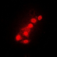 FOXO1 Rabbit Polyclonal Antibody
