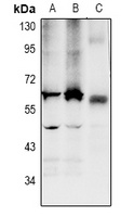 LPCAT2 Rabbit Polyclonal Antibody