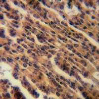 LPCAT2 Rabbit Polyclonal Antibody