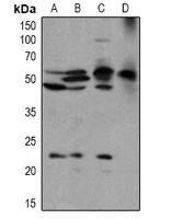 BLK (Phospho-Y389) Rabbit Polyclonal Antibody