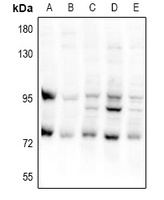 CEP95 Rabbit Polyclonal Antibody