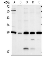 Caveolin 2 Rabbit Polyclonal Antibody