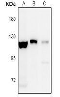 EPHA8 (Phospho-Y838) Rabbit Polyclonal Antibody