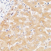 CD85e Rabbit Polyclonal Antibody