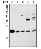 RAP2B Rabbit Polyclonal Antibody
