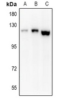 EPHA8 Rabbit Polyclonal Antibody