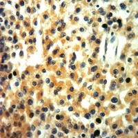EPHA8 Rabbit Polyclonal Antibody