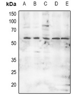 MNK2 (Phospho-T249) Rabbit Polyclonal Antibody