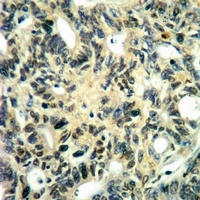 MNK2 (Phospho-T249) Rabbit Polyclonal Antibody