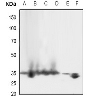 LAT (Phospho-Y161) Rabbit Polyclonal Antibody