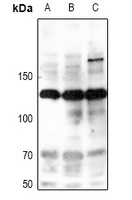 iNOS (Phospho-Y151) Rabbit Polyclonal Antibody
